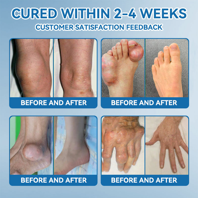 👑𝖯𝗂𝖼𝗱𝗼® 𝑩𝑷𝑪-157 𝑱𝒐𝒊𝒏𝒕 𝑯𝒆𝒂𝒍𝒊𝒏𝒈 𝑪𝒓𝒆𝒂𝒎🦴𝑻𝒓𝒆𝒂𝒕𝒔 𝑨𝒓𝒕𝒉𝒓𝒊𝒕𝒊𝒔, 𝑵𝒆𝒖𝒓𝒐𝒑𝒂𝒕𝒉𝒚, 𝑹𝒉𝒆𝒖𝒎𝒂𝒕𝒊𝒔𝒎, 𝑺𝒑𝒐𝒓𝒕𝒔 𝑰𝒏𝒋𝒖𝒓𝒊𝒆𝒔 & 𝑴𝒐𝒓𝒆