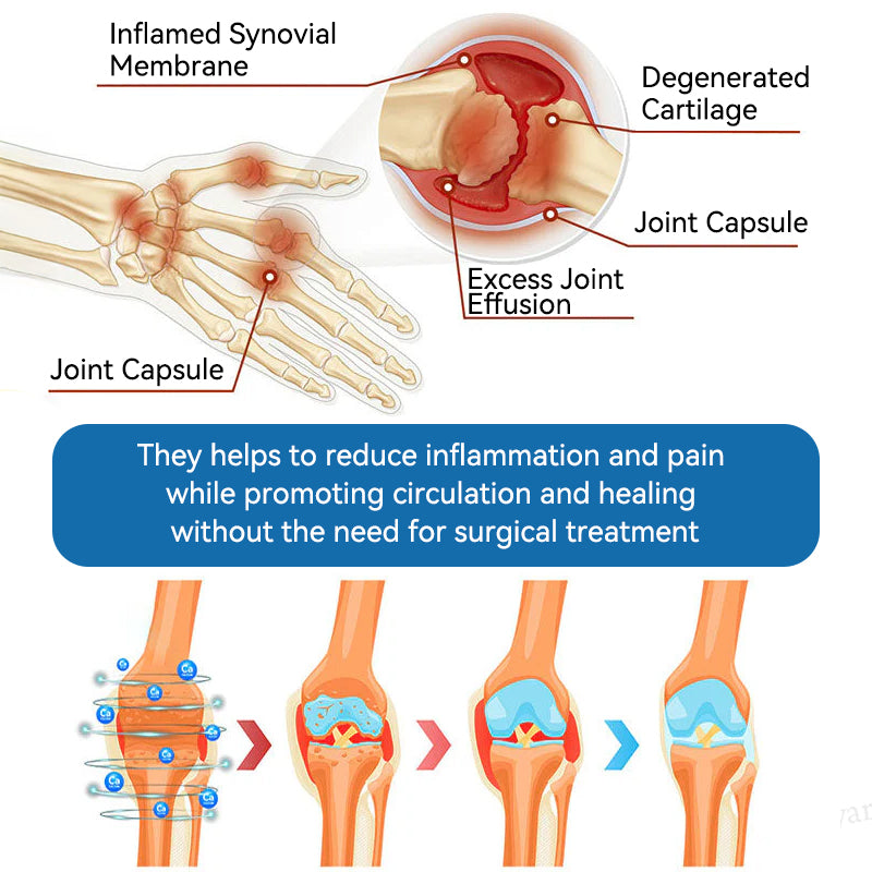 👑𝖯𝗂𝖼𝗱𝗼® 𝑩𝑷𝑪-157 𝑱𝒐𝒊𝒏𝒕 𝑯𝒆𝒂𝒍𝒊𝒏𝒈 𝑪𝒓𝒆𝒂𝒎🦴𝑻𝒓𝒆𝒂𝒕𝒔 𝑨𝒓𝒕𝒉𝒓𝒊𝒕𝒊𝒔, 𝑵𝒆𝒖𝒓𝒐𝒑𝒂𝒕𝒉𝒚, 𝑹𝒉𝒆𝒖𝒎𝒂𝒕𝒊𝒔𝒎, 𝑺𝒑𝒐𝒓𝒕𝒔 𝑰𝒏𝒋𝒖𝒓𝒊𝒆𝒔 & 𝑴𝒐𝒓𝒆