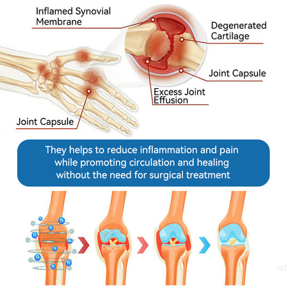 👑𝖯𝗂𝖼𝗱𝗼® 𝑩𝑷𝑪-157 𝑱𝒐𝒊𝒏𝒕 𝑯𝒆𝒂𝒍𝒊𝒏𝒈 𝑪𝒓𝒆𝒂𝒎🦴𝑻𝒓𝒆𝒂𝒕𝒔 𝑨𝒓𝒕𝒉𝒓𝒊𝒕𝒊𝒔, 𝑵𝒆𝒖𝒓𝒐𝒑𝒂𝒕𝒉𝒚, 𝑹𝒉𝒆𝒖𝒎𝒂𝒕𝒊𝒔𝒎, 𝑺𝒑𝒐𝒓𝒕𝒔 𝑰𝒏𝒋𝒖𝒓𝒊𝒆𝒔 & 𝑴𝒐𝒓𝒆