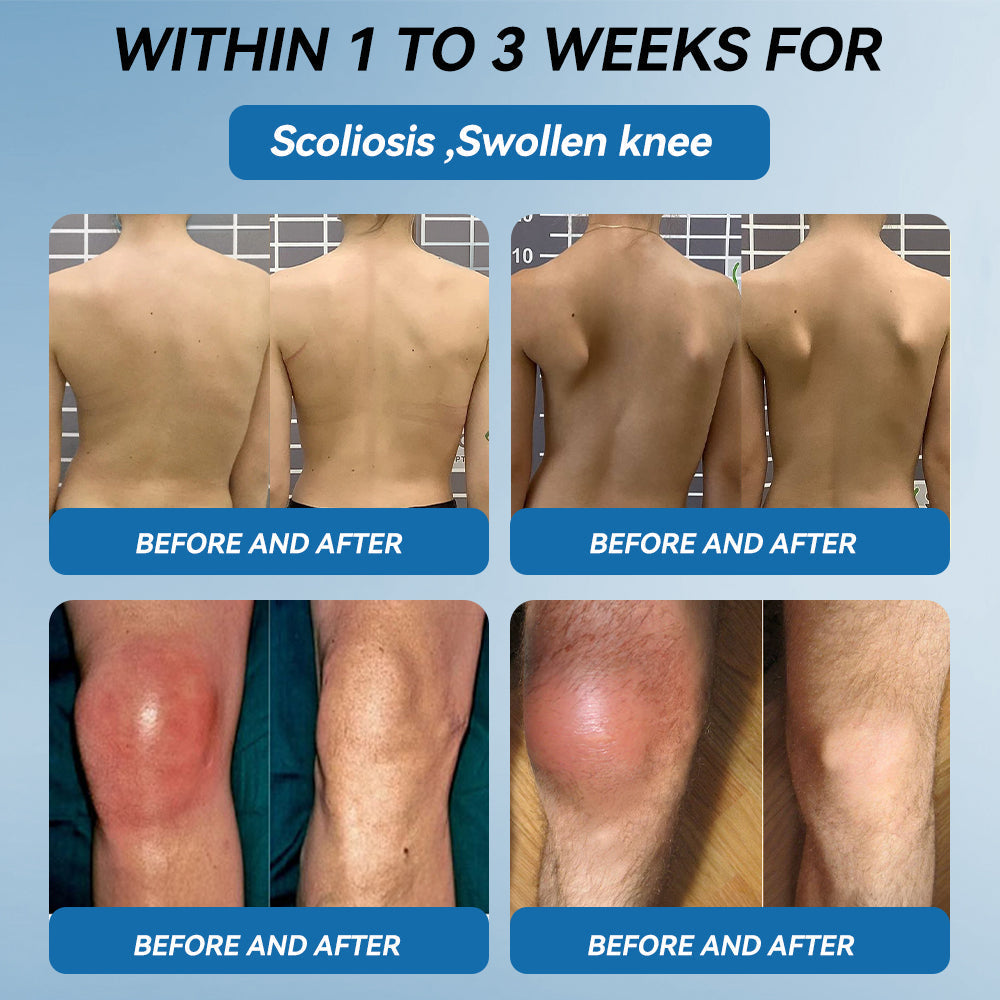 👑𝖯𝗂𝖼𝗱𝗼® 𝑩𝑷𝑪-157 𝑱𝒐𝒊𝒏𝒕 𝑯𝒆𝒂𝒍𝒊𝒏𝒈 𝑪𝒓𝒆𝒂𝒎🦴𝑻𝒓𝒆𝒂𝒕𝒔 𝑨𝒓𝒕𝒉𝒓𝒊𝒕𝒊𝒔, 𝑵𝒆𝒖𝒓𝒐𝒑𝒂𝒕𝒉𝒚, 𝑹𝒉𝒆𝒖𝒎𝒂𝒕𝒊𝒔𝒎, 𝑺𝒑𝒐𝒓𝒕𝒔 𝑰𝒏𝒋𝒖𝒓𝒊𝒆𝒔 & 𝑴𝒐𝒓𝒆